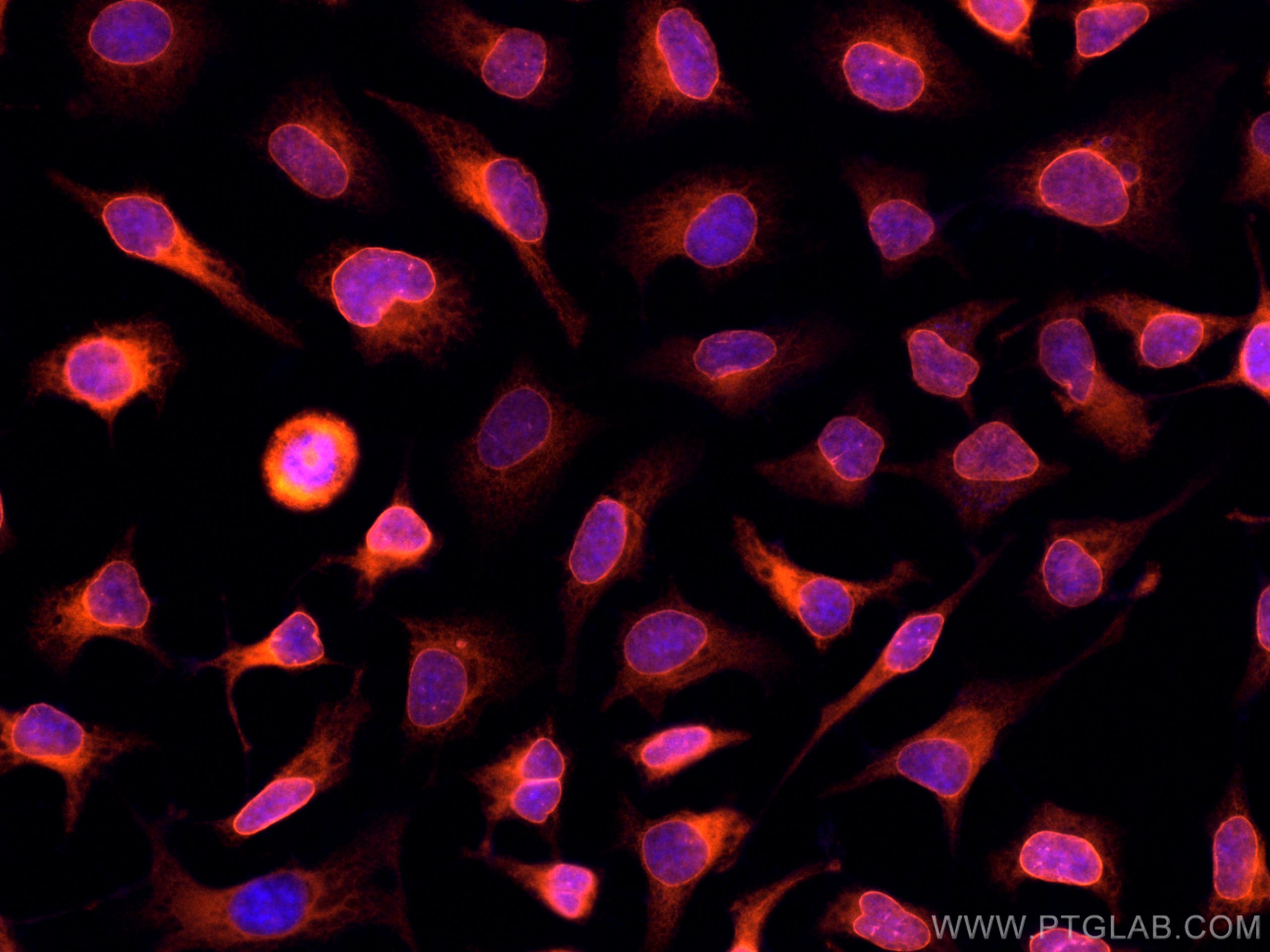 IF Staining of HeLa using CL555-12398