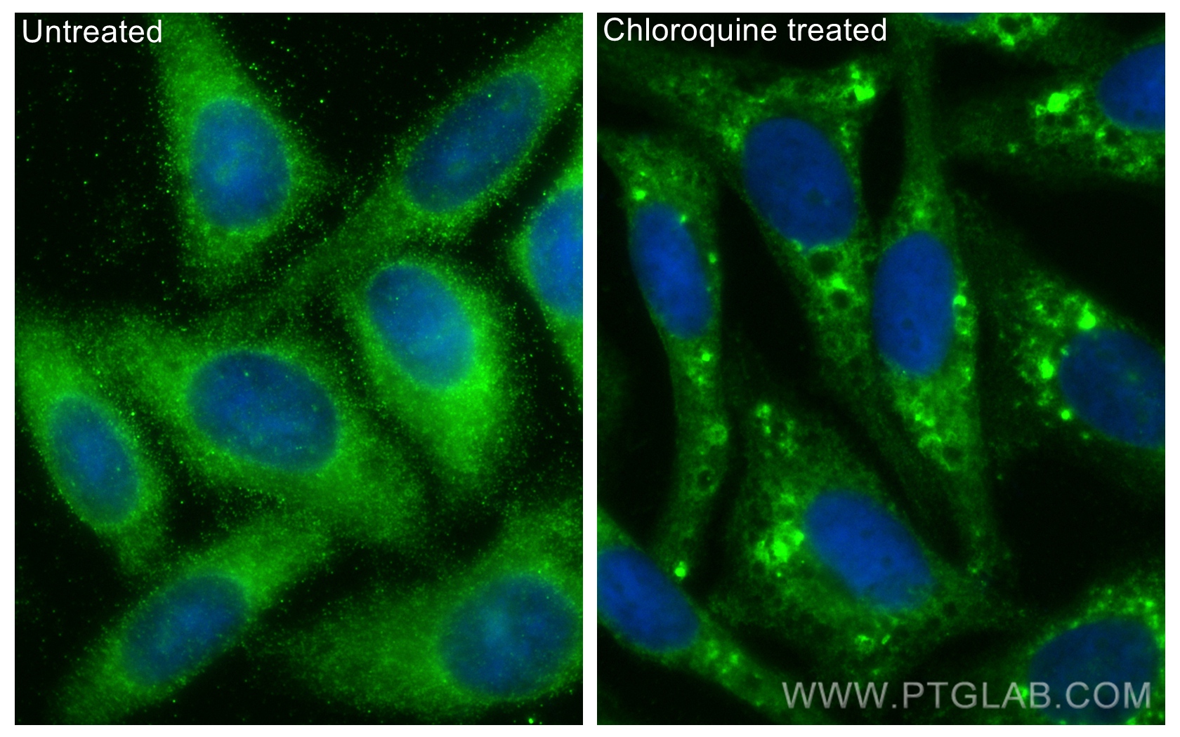 IF Staining of HepG2 using CL488-18725