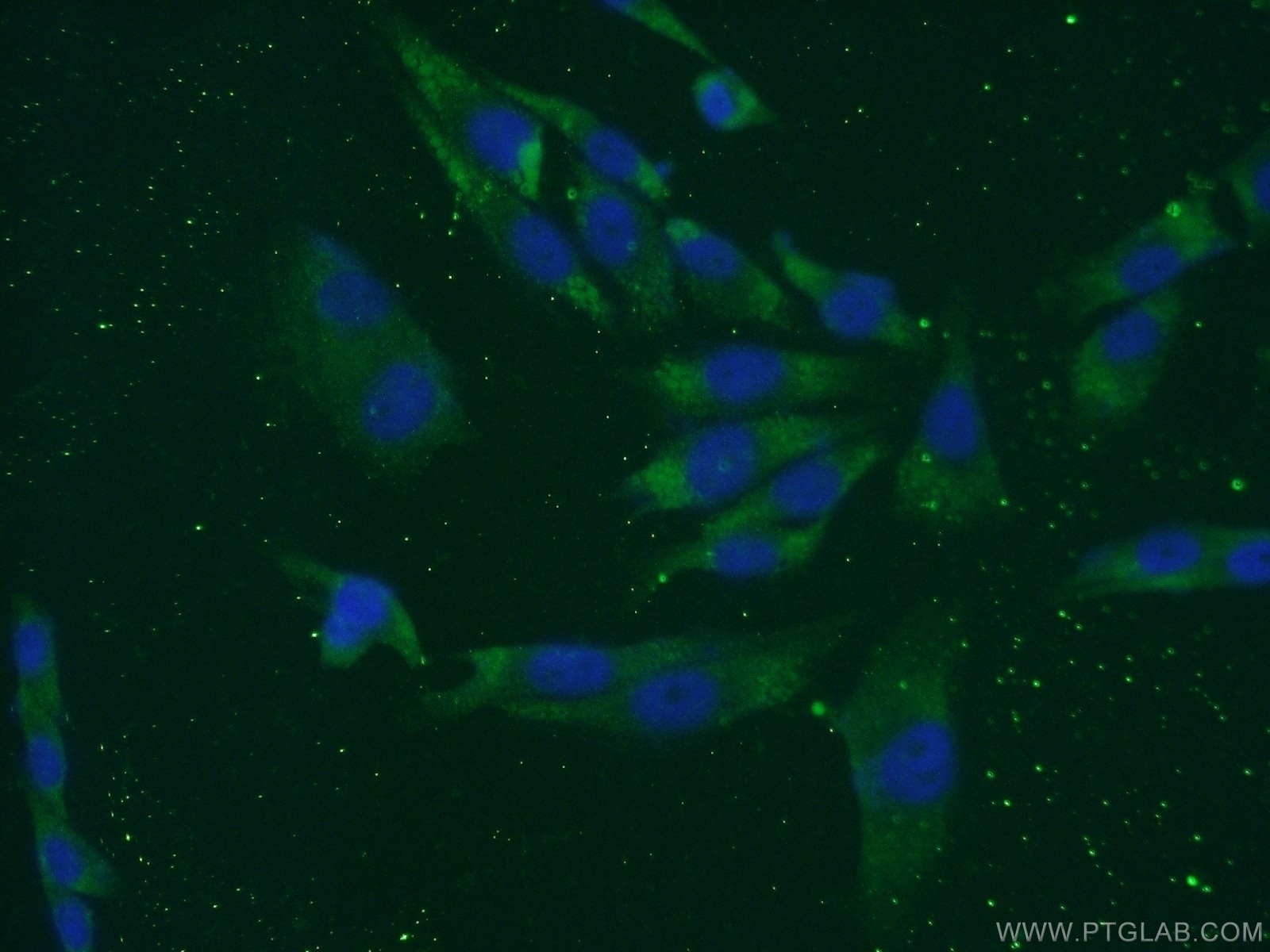 IF Staining of A375 using 21771-1-AP