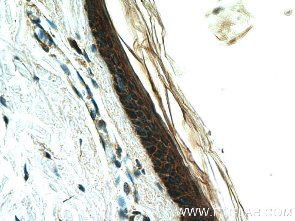 IHC staining of human skin using 26512-1-AP