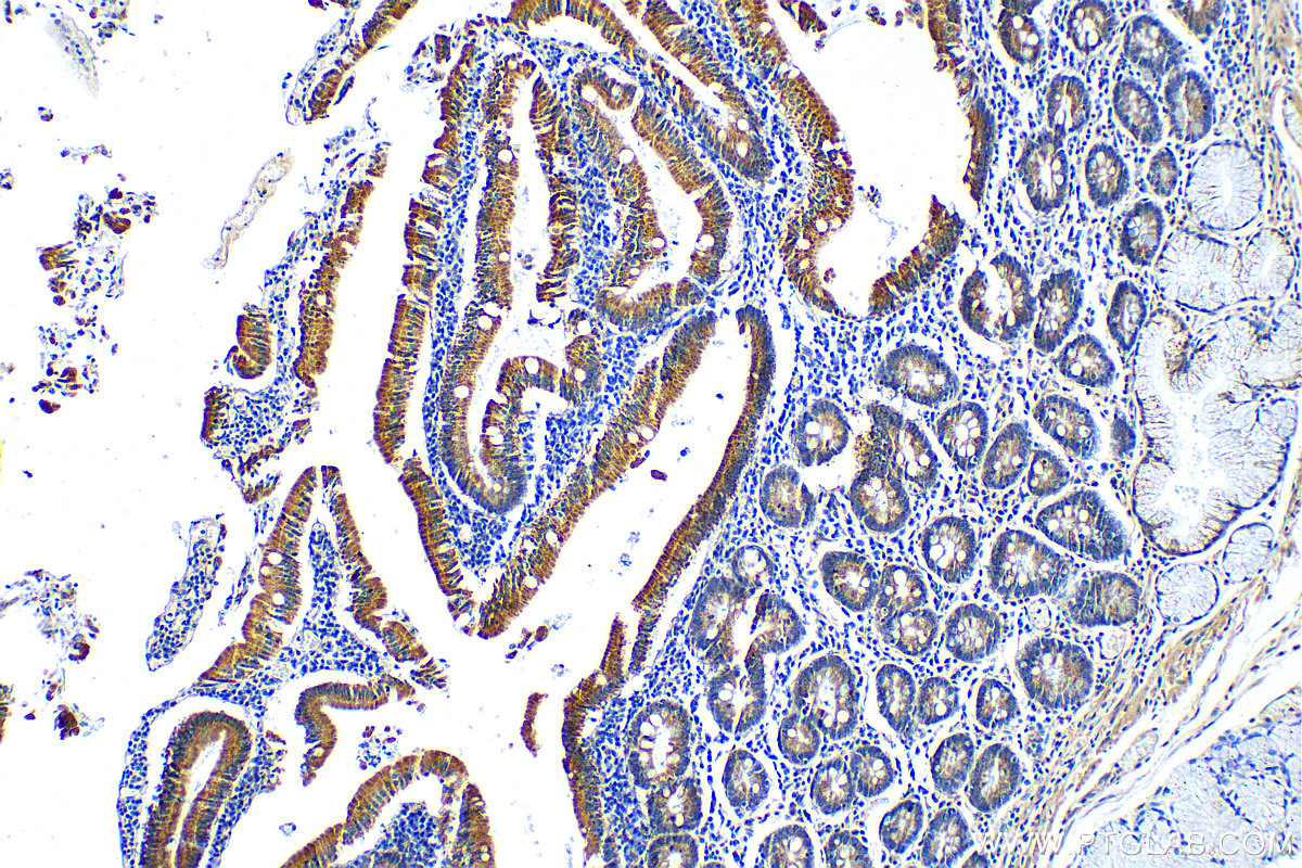 IHC staining of human stomach using 17793-1-AP