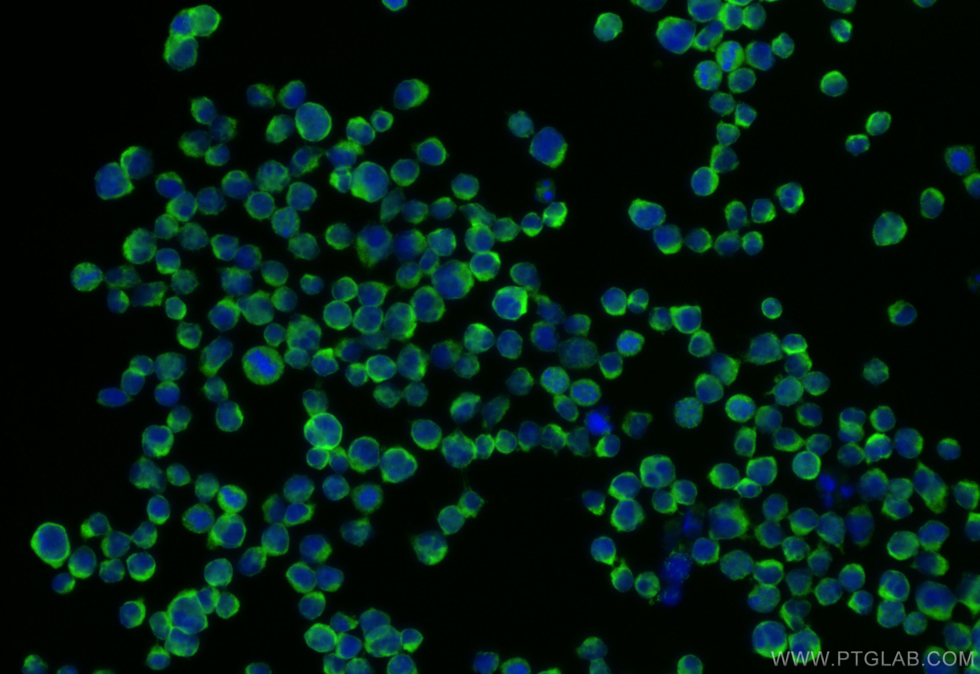 IF Staining of Jurkat using 12728-1-AP