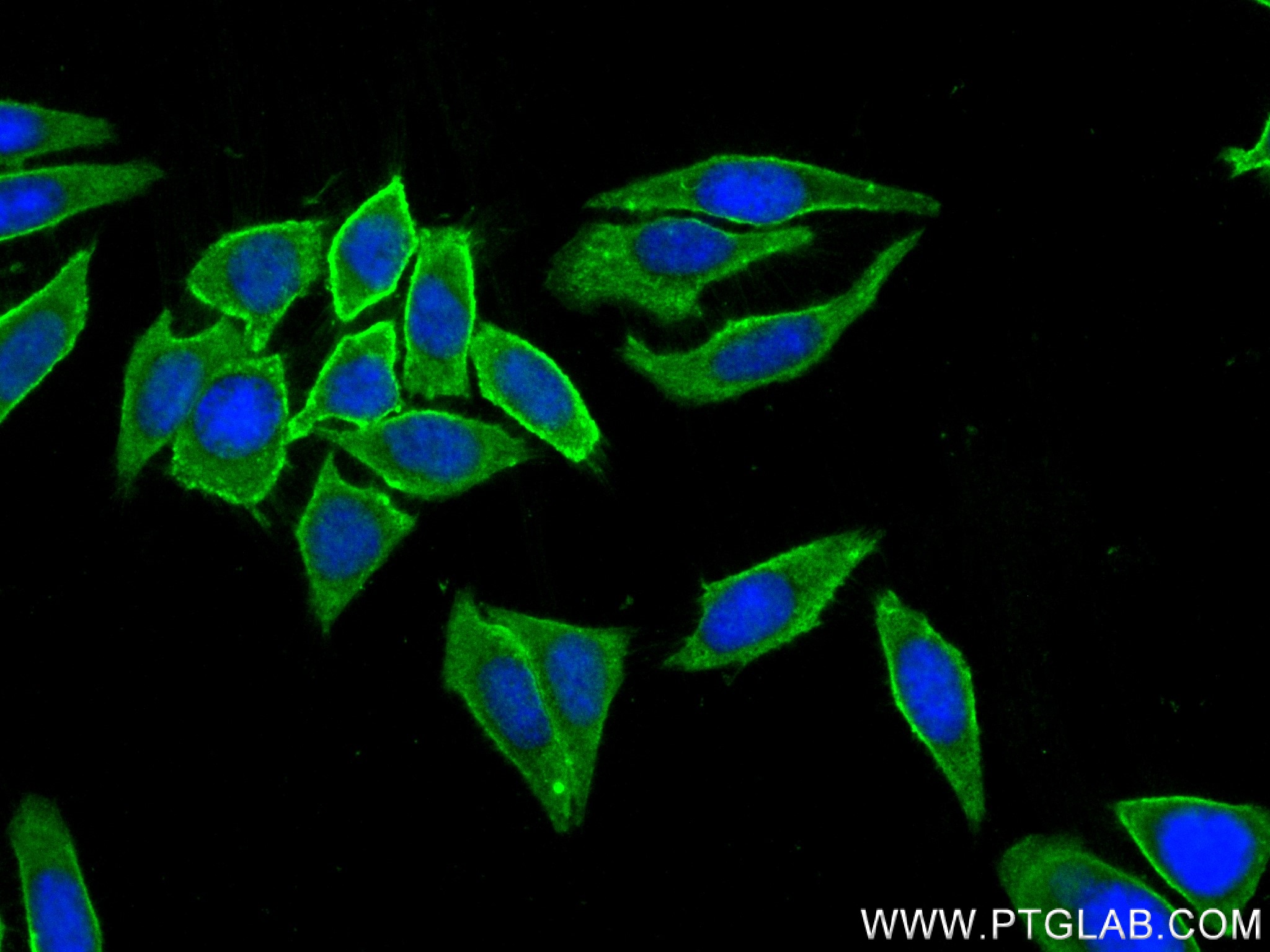 IF Staining of HepG2 using 84198-1-PBS