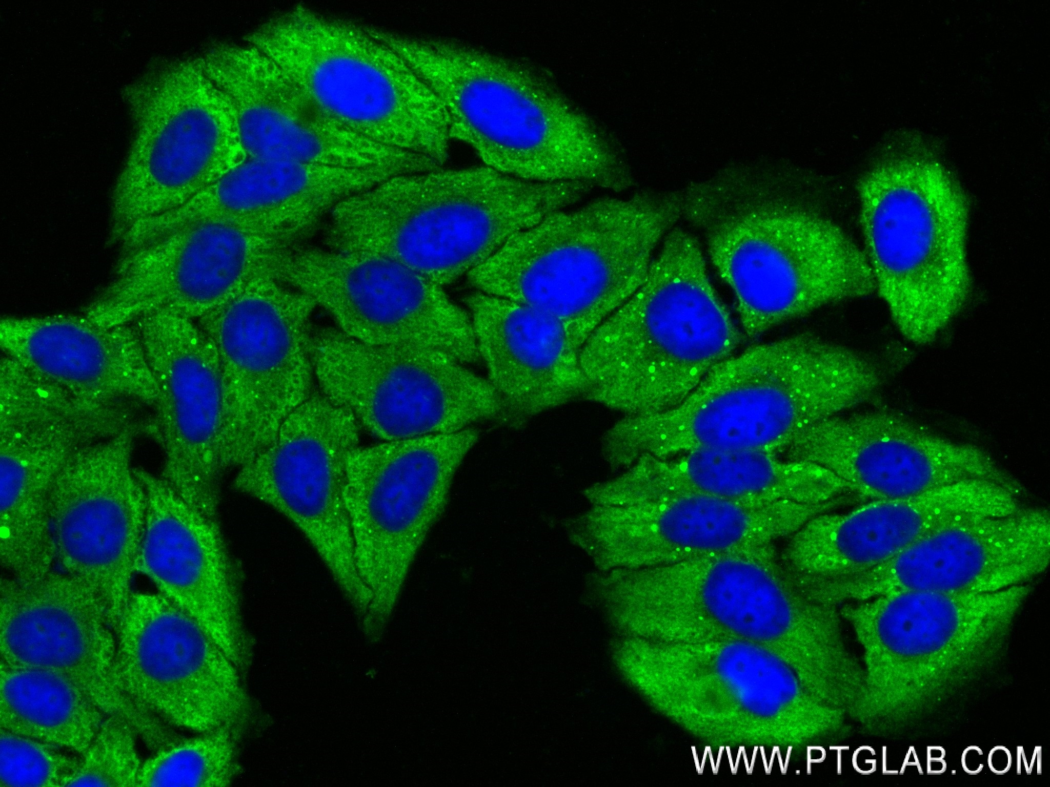 IF Staining of HepG2 using 84198-1-RR (same clone as 84198-1-PBS)