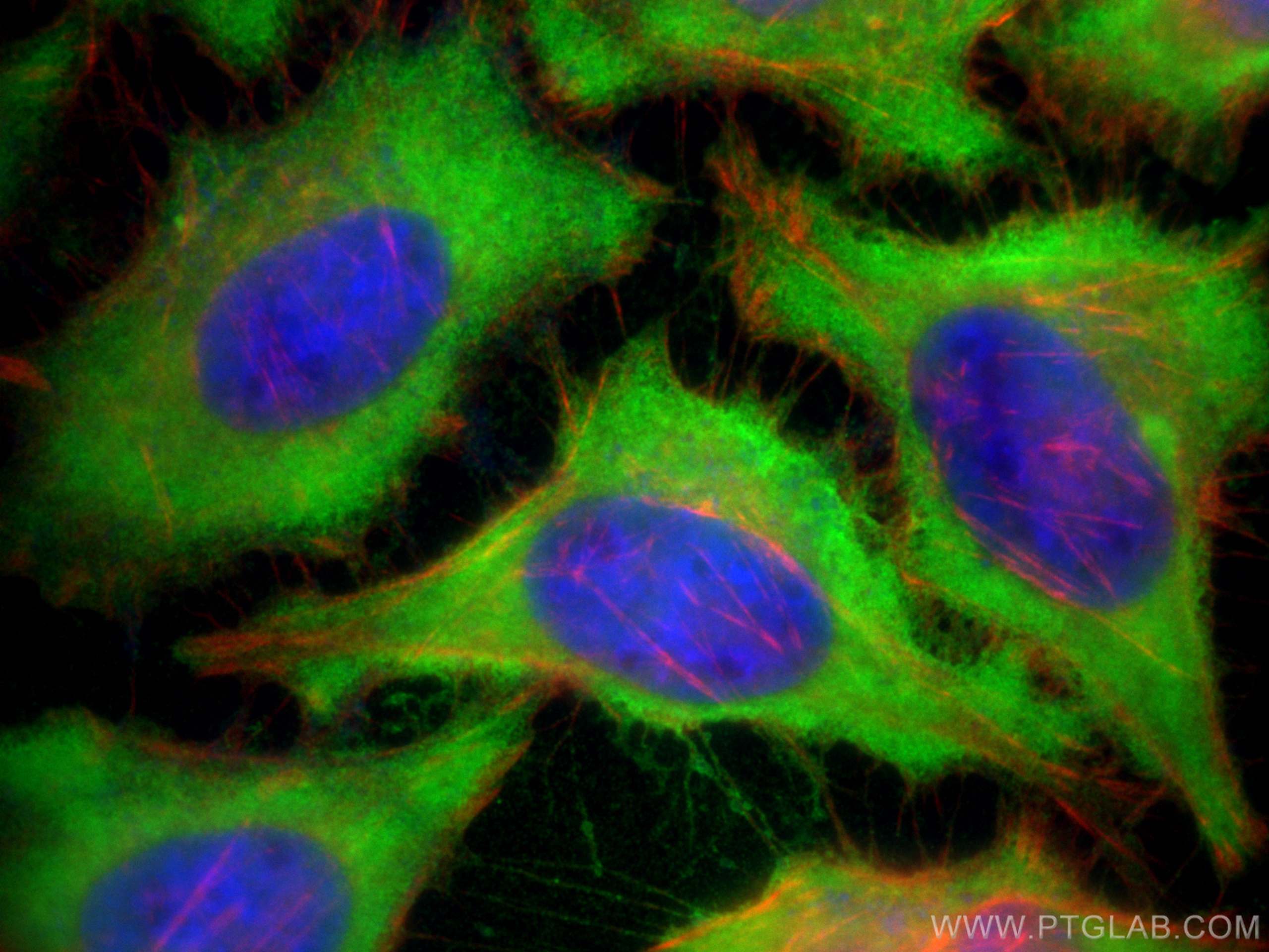 IF Staining of HeLa using 14824-1-AP