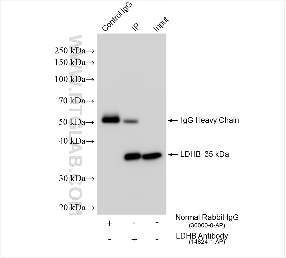 IP experiment of mouse brain using 14824-1-AP