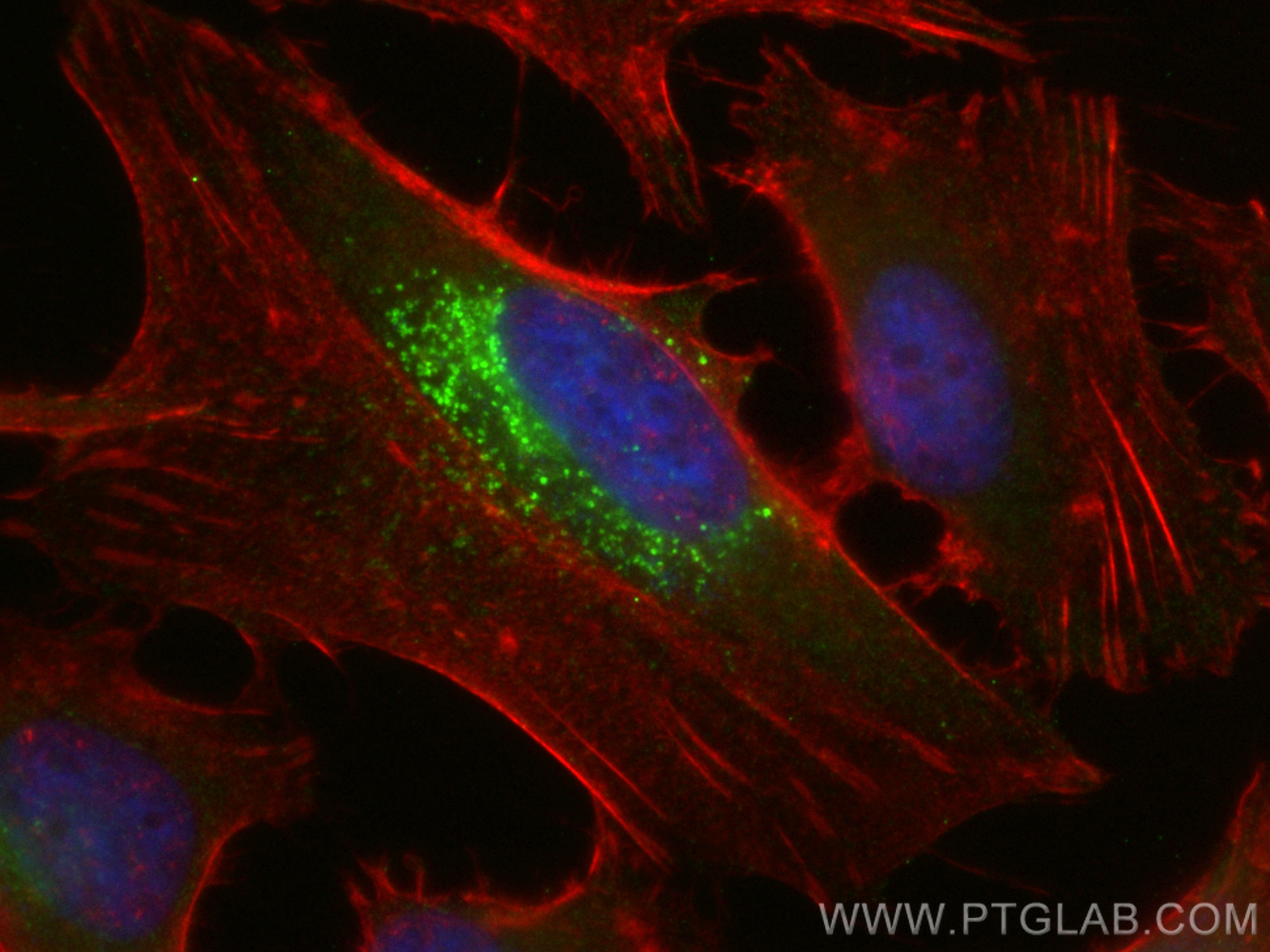 IF Staining of HeLa using 82724-1-RR