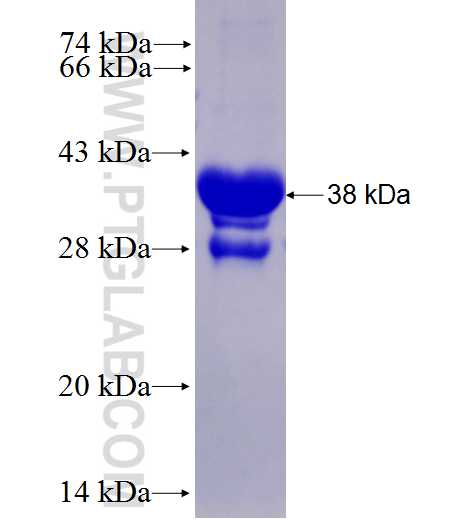 LDLRAD3 fusion protein Ag27461 SDS-PAGE