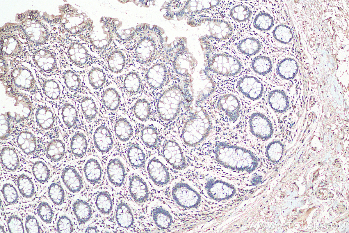 IHC staining of human colon using 29406-1-AP