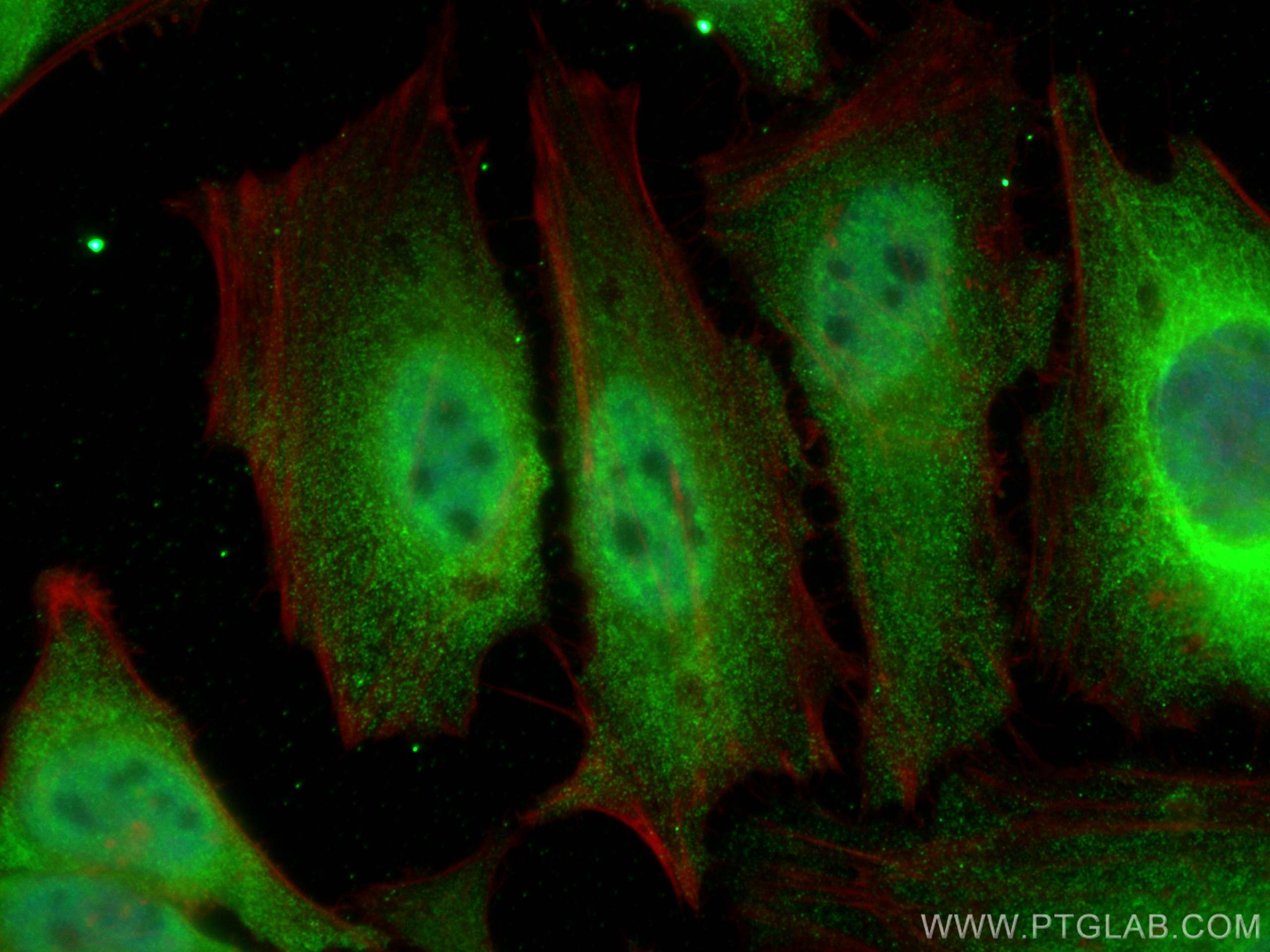 IF Staining of HeLa using 16295-1-AP