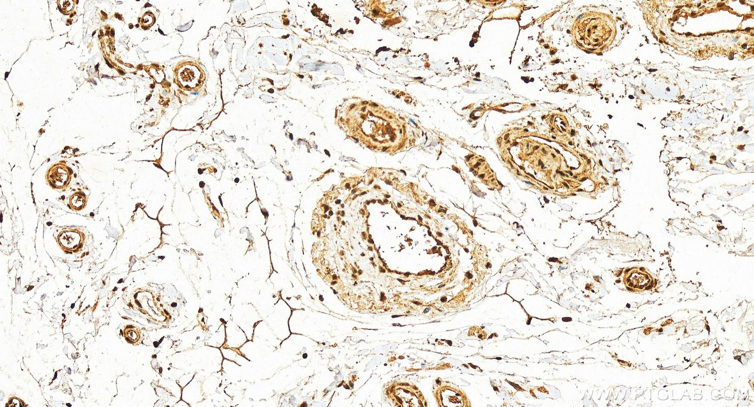 IHC staining of human colon using 12281-1-AP