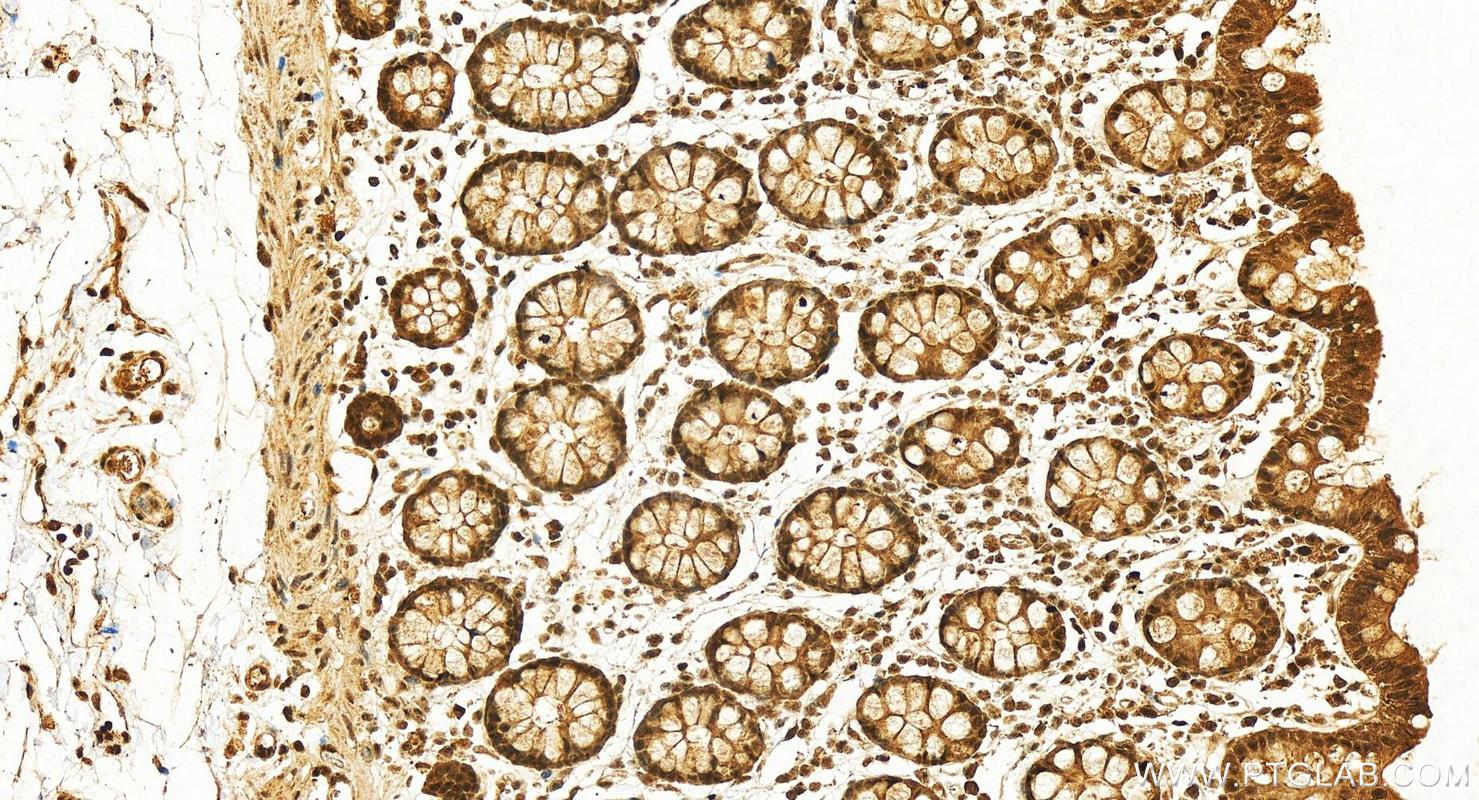 IHC staining of human colon using 12281-1-AP