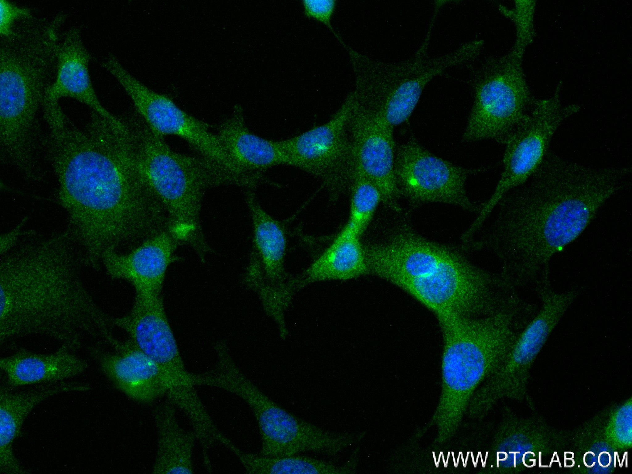 IF Staining of 3T3-L1 using 84072-5-RR