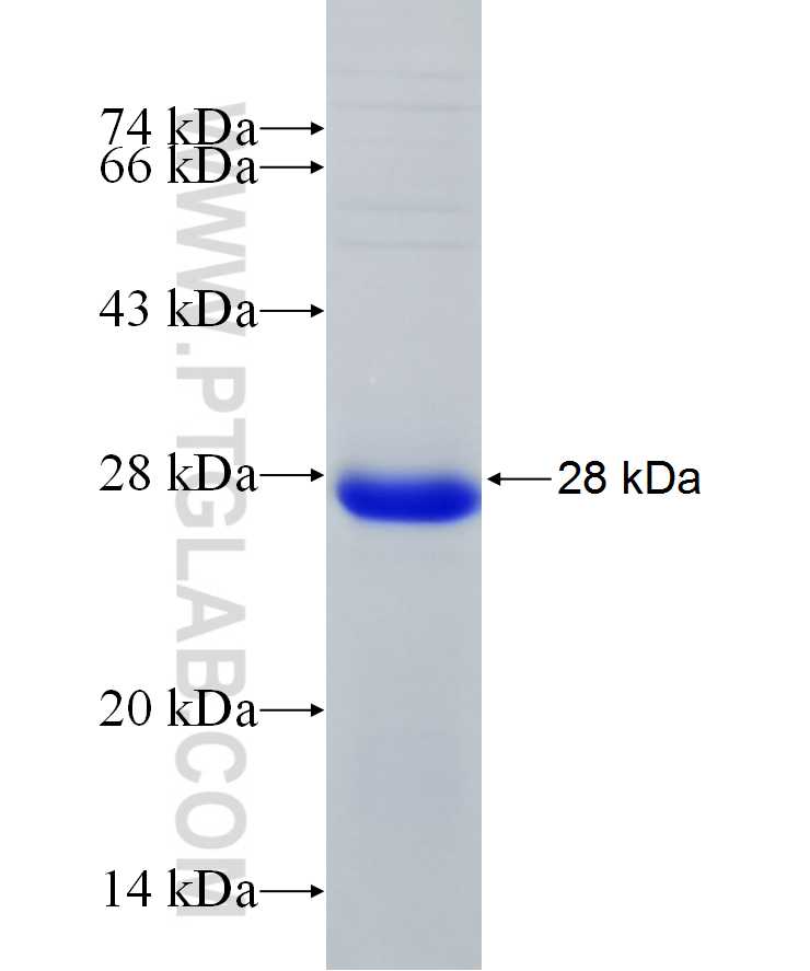 LEPR fusion protein Ag29621 SDS-PAGE