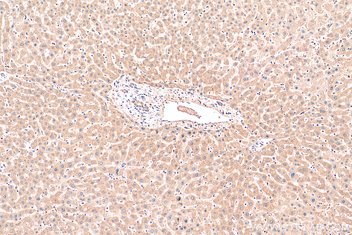 IHC staining of human liver using 15723-1-AP