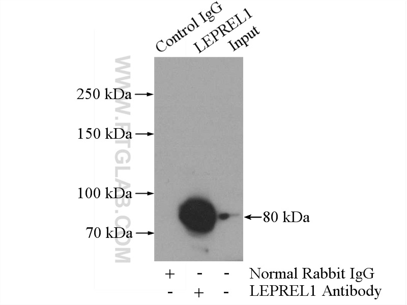 IP experiment of mouse kidney using 15723-1-AP