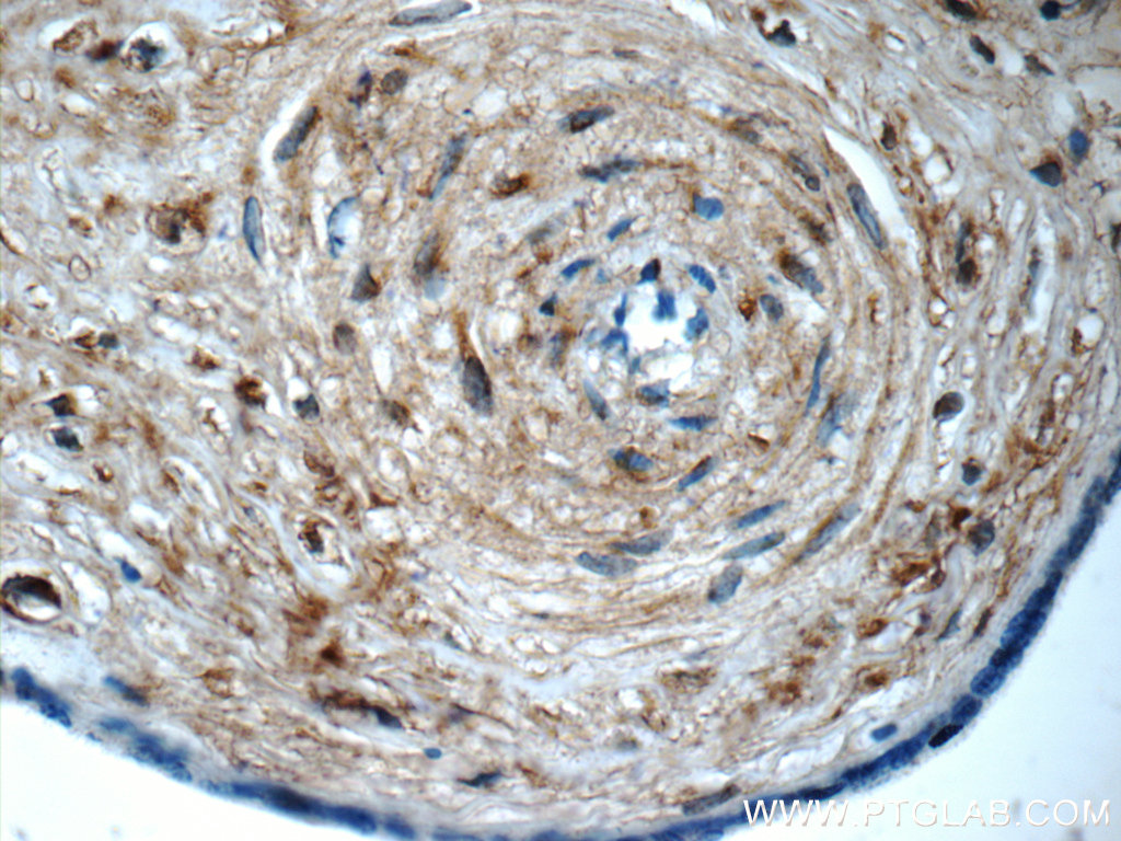 IHC staining of human placenta using 17180-1-AP