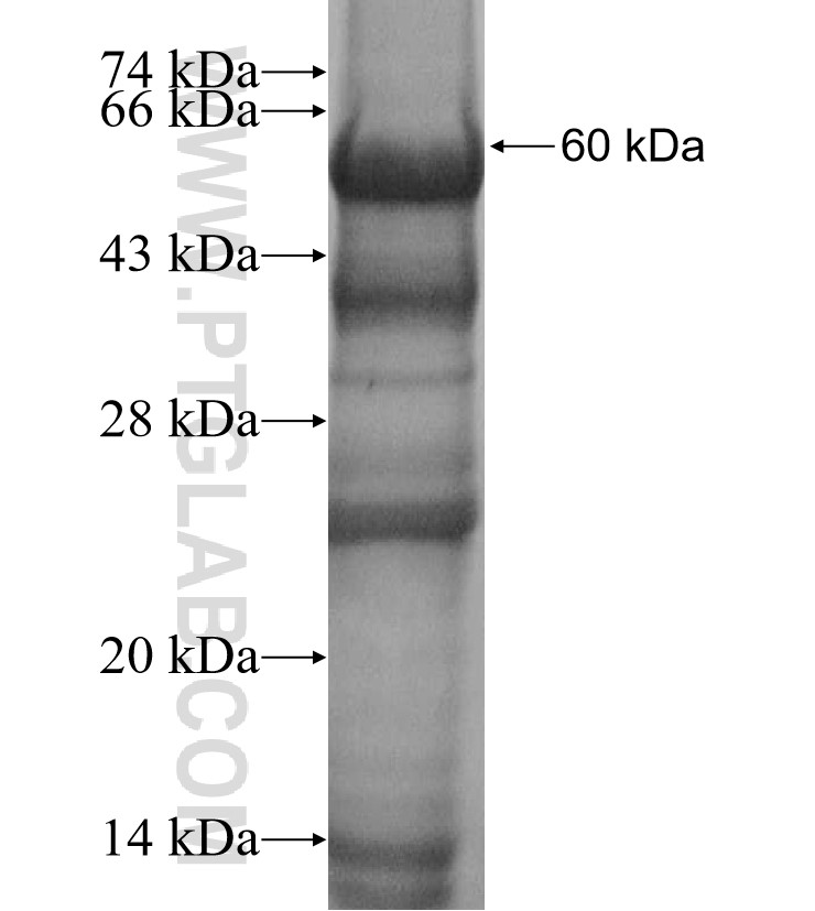 LGI1 fusion protein Ag3184 SDS-PAGE