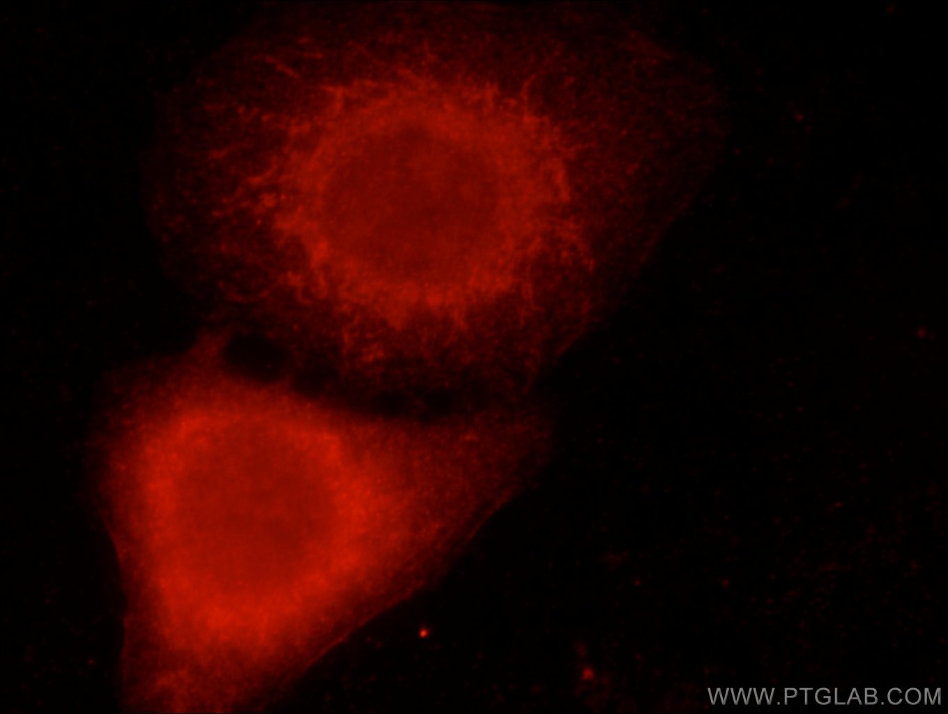 IF Staining of HepG2 using 21919-1-AP