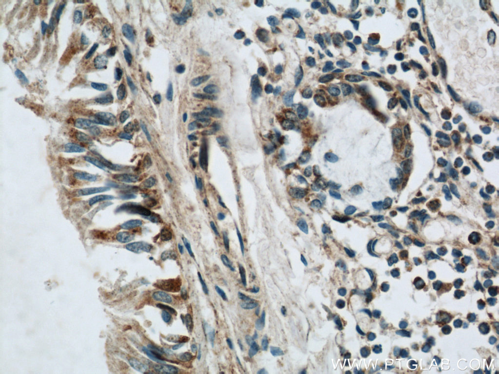 IHC staining of human lung using 21919-1-AP