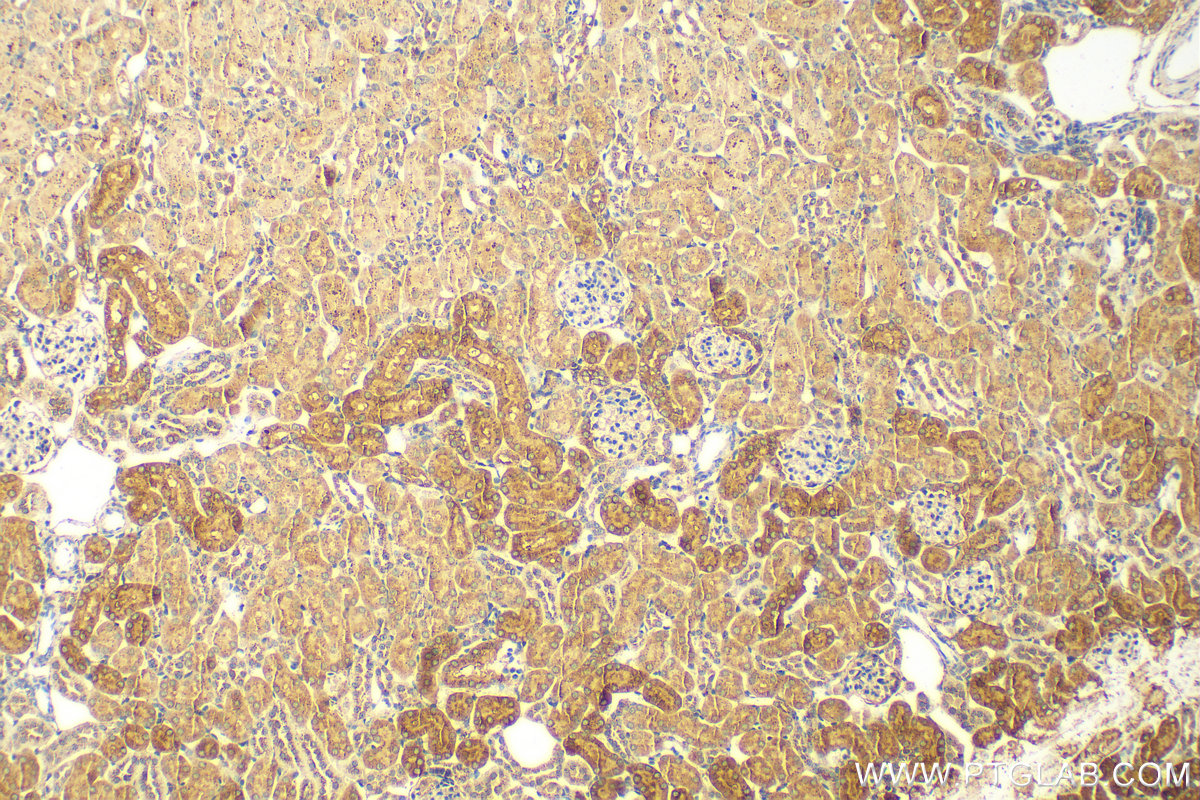 IHC staining of mouse kidney using 15095-1-AP