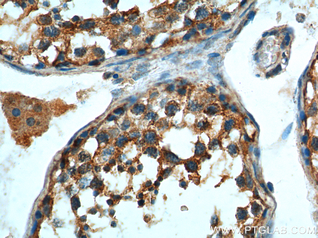 IHC staining of human testis using 17658-1-AP