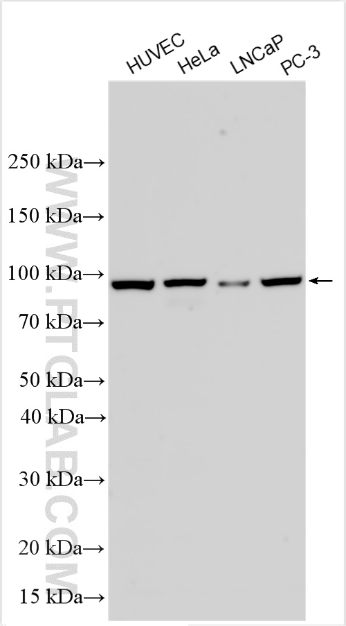 WB analysis using 17658-1-AP