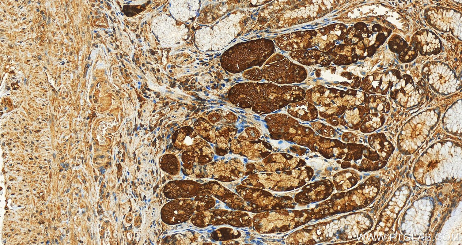 IHC staining of human stomach using 12840-1-AP