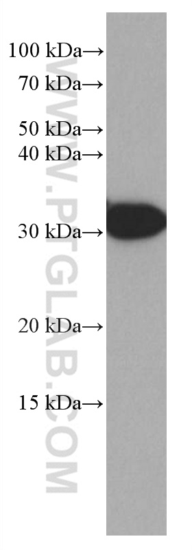 WB analysis of rat liver using 66988-1-Ig