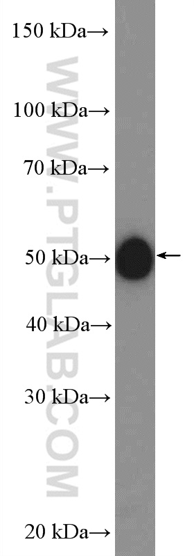 WB analysis of mouse brain using 20745-1-AP