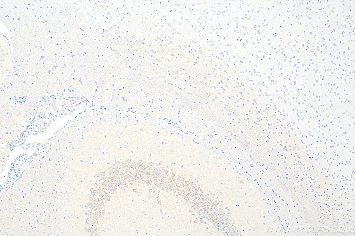 IHC staining of mouse brain using 67298-1-Ig (same clone as 67298-1-PBS)