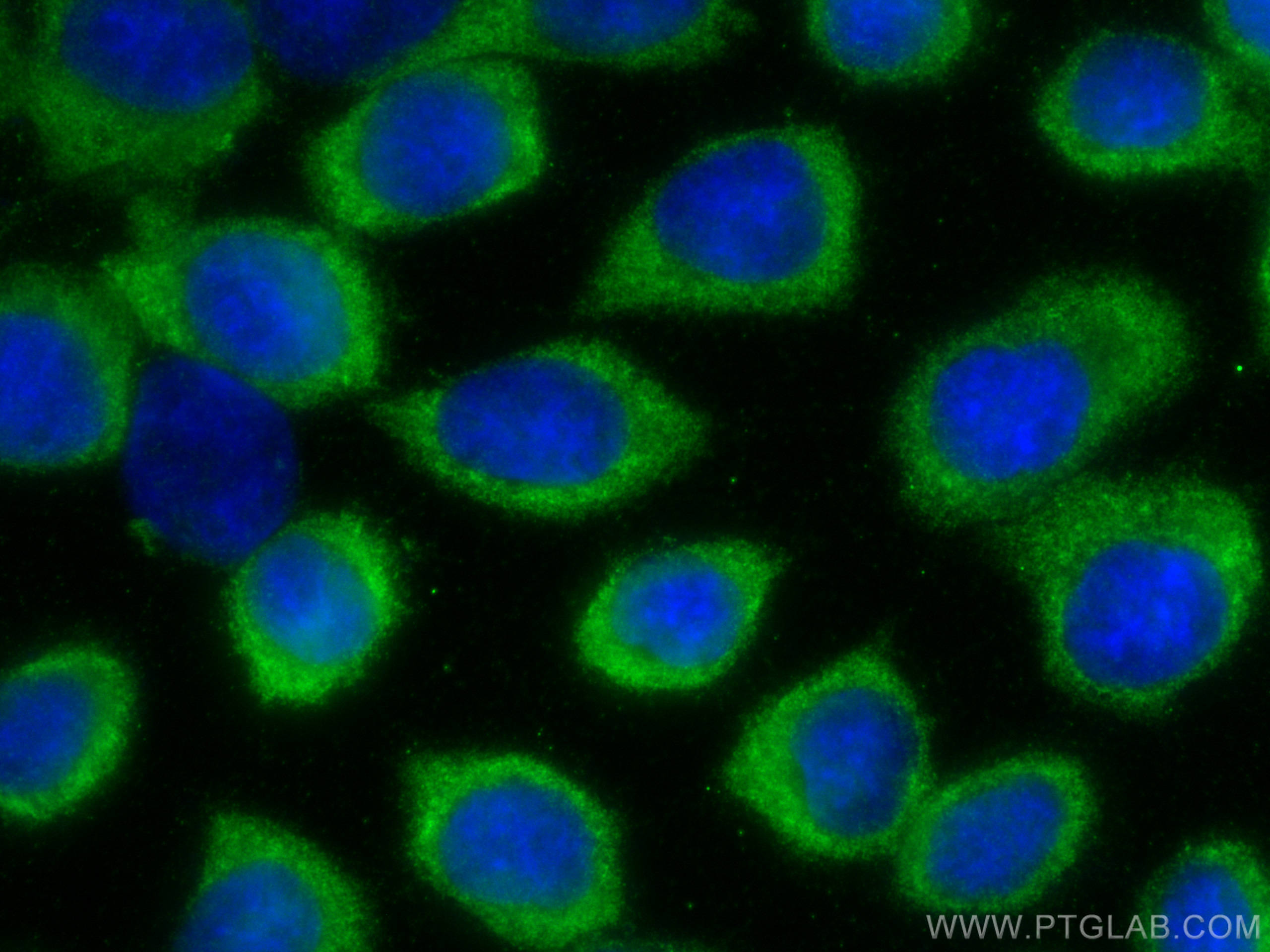 IF Staining of A431 using 26757-1-AP