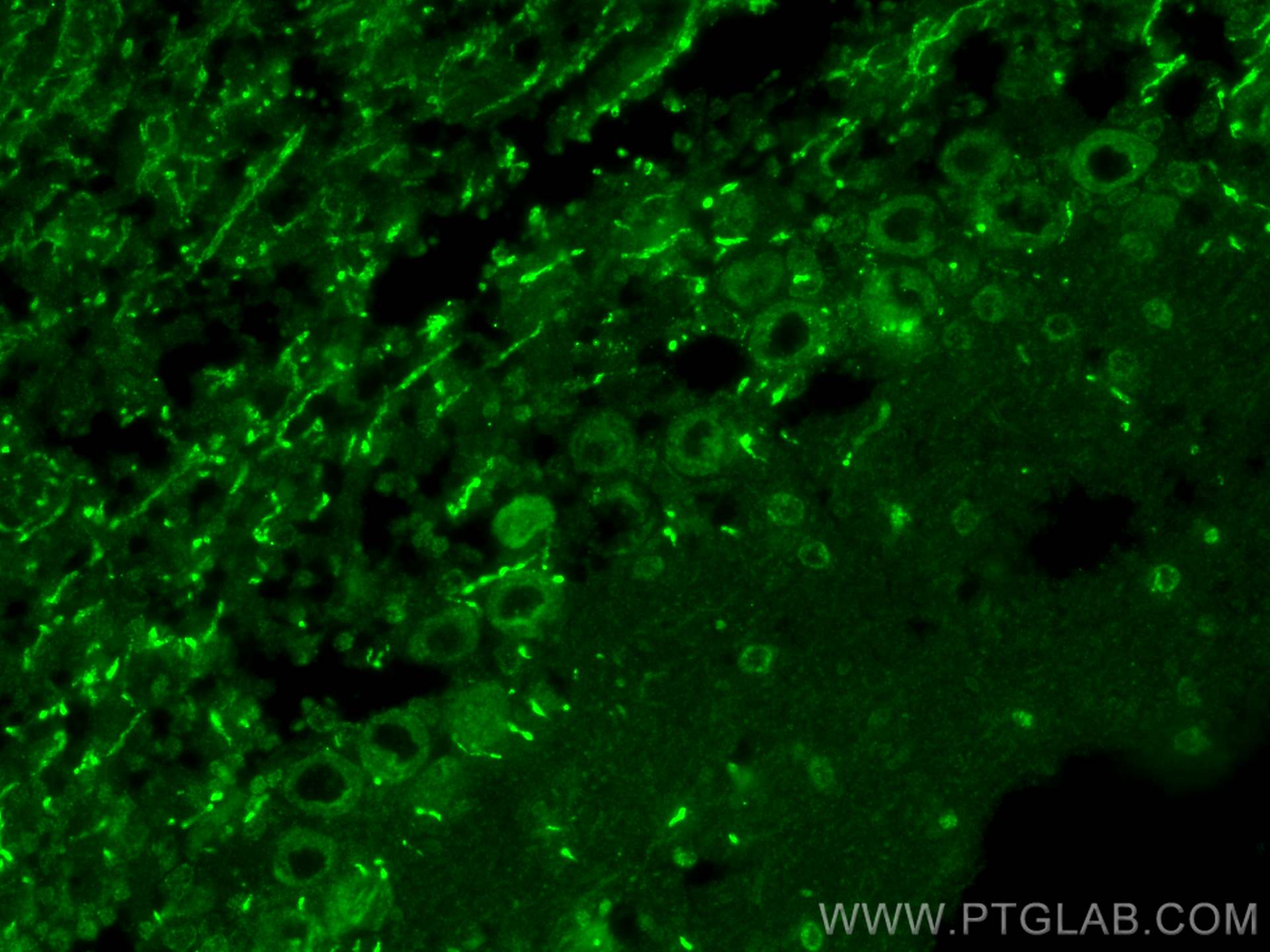 IF Staining of mouse cerebellum using 22779-1-AP