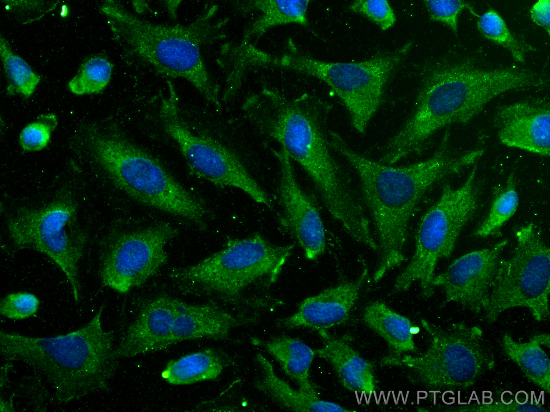 IF Staining of HeLa using 22779-1-AP