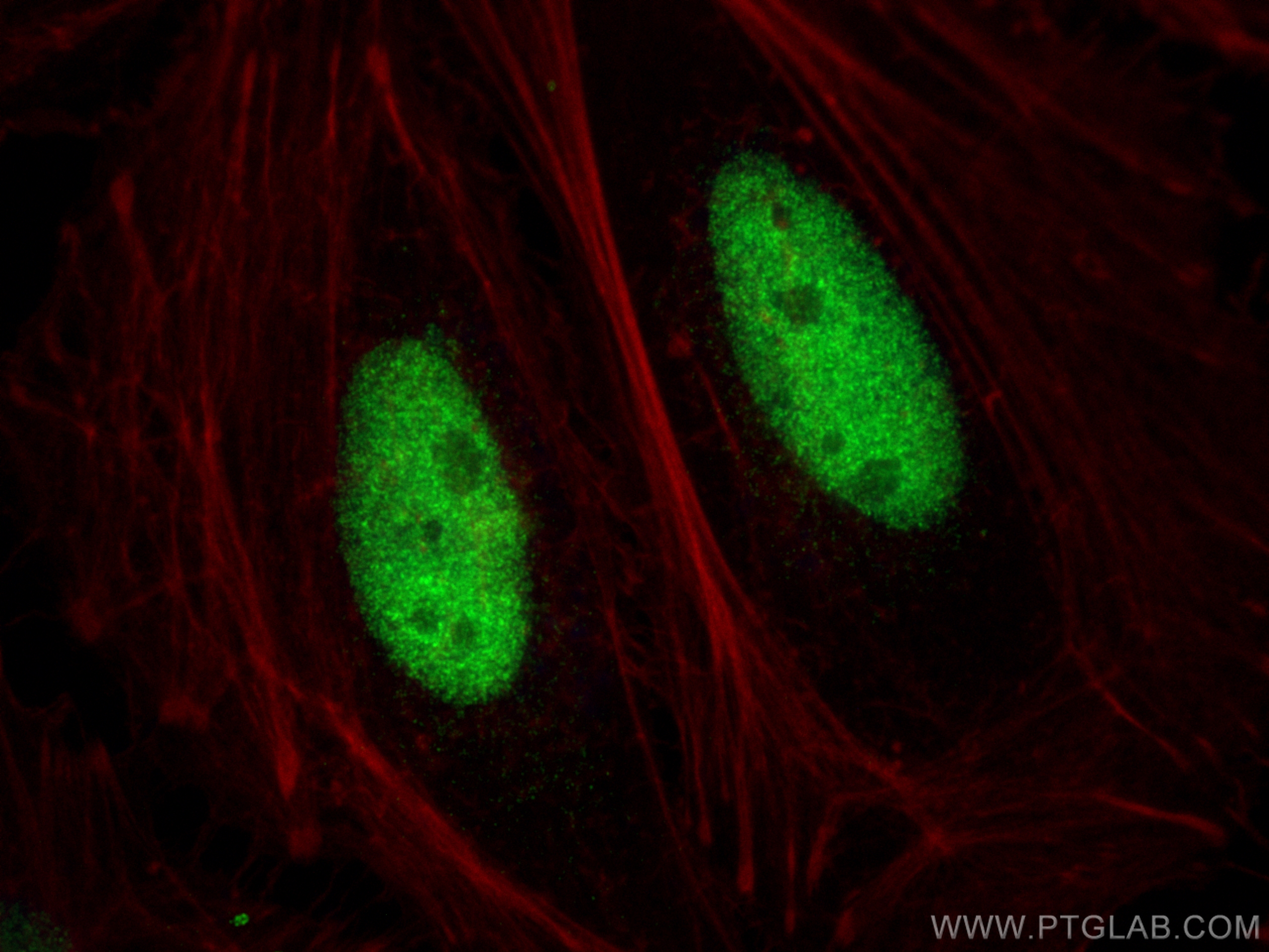 IF Staining of HeLa using 26583-1-AP