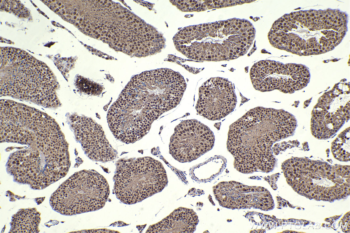 IHC staining of mouse testis using 26583-1-AP