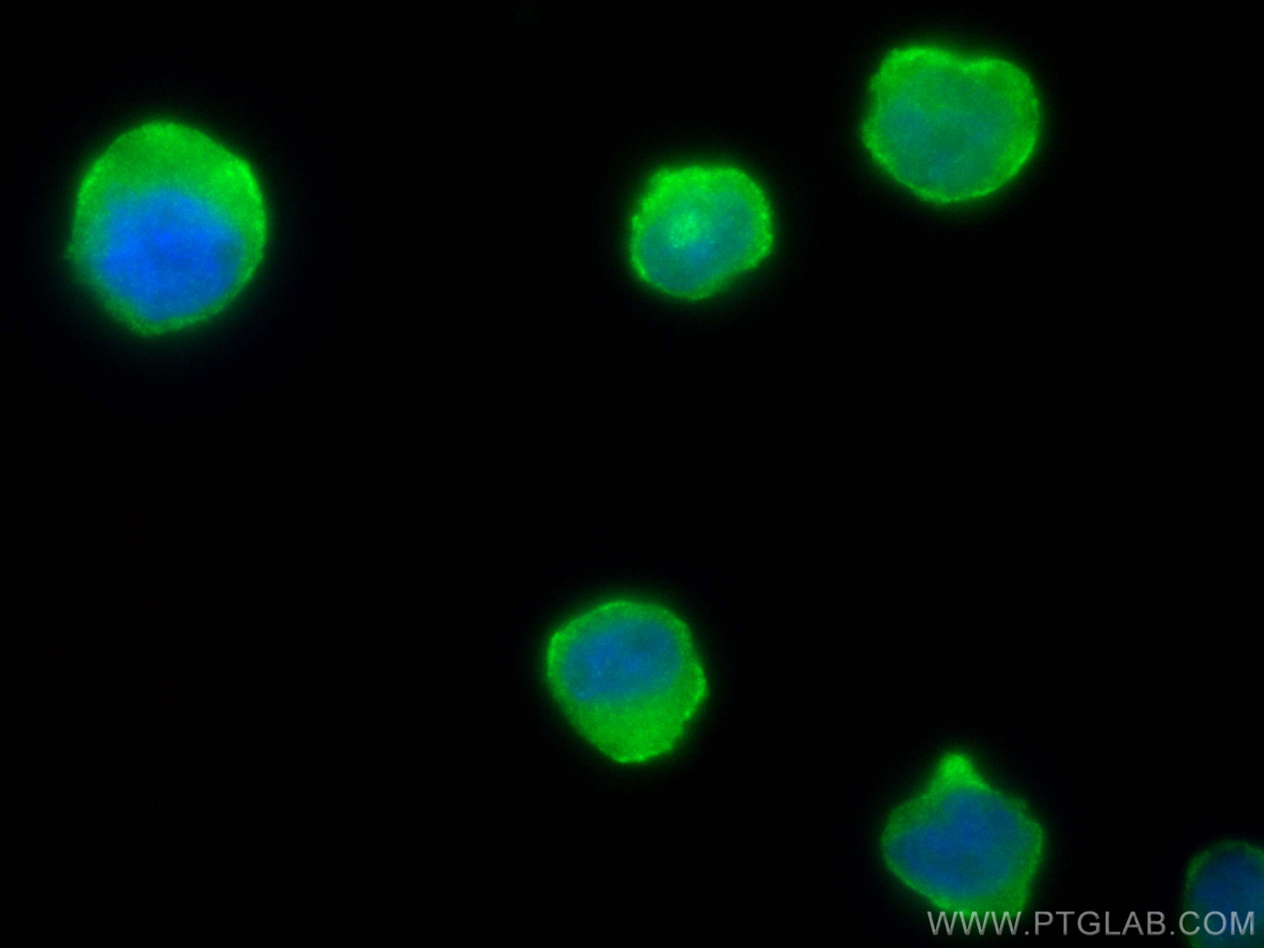 IF Staining of THP-1 using 14154-1-AP