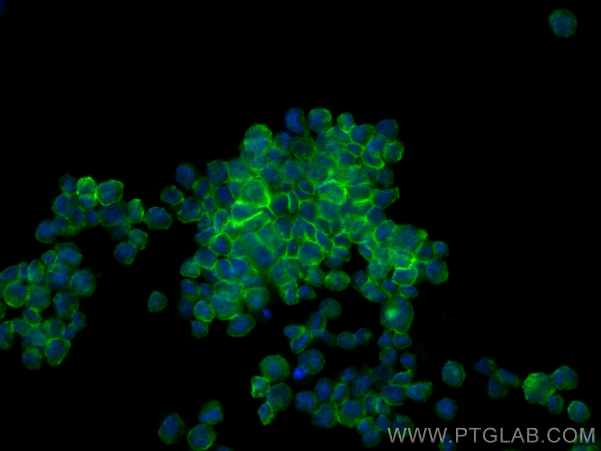 IF Staining of THP-1 using 14154-1-AP