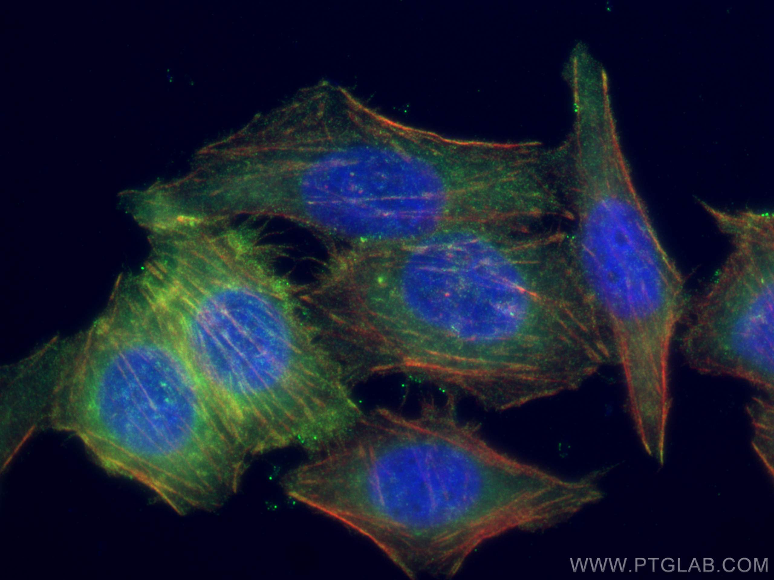 IF Staining of PC-3 using 16639-1-AP