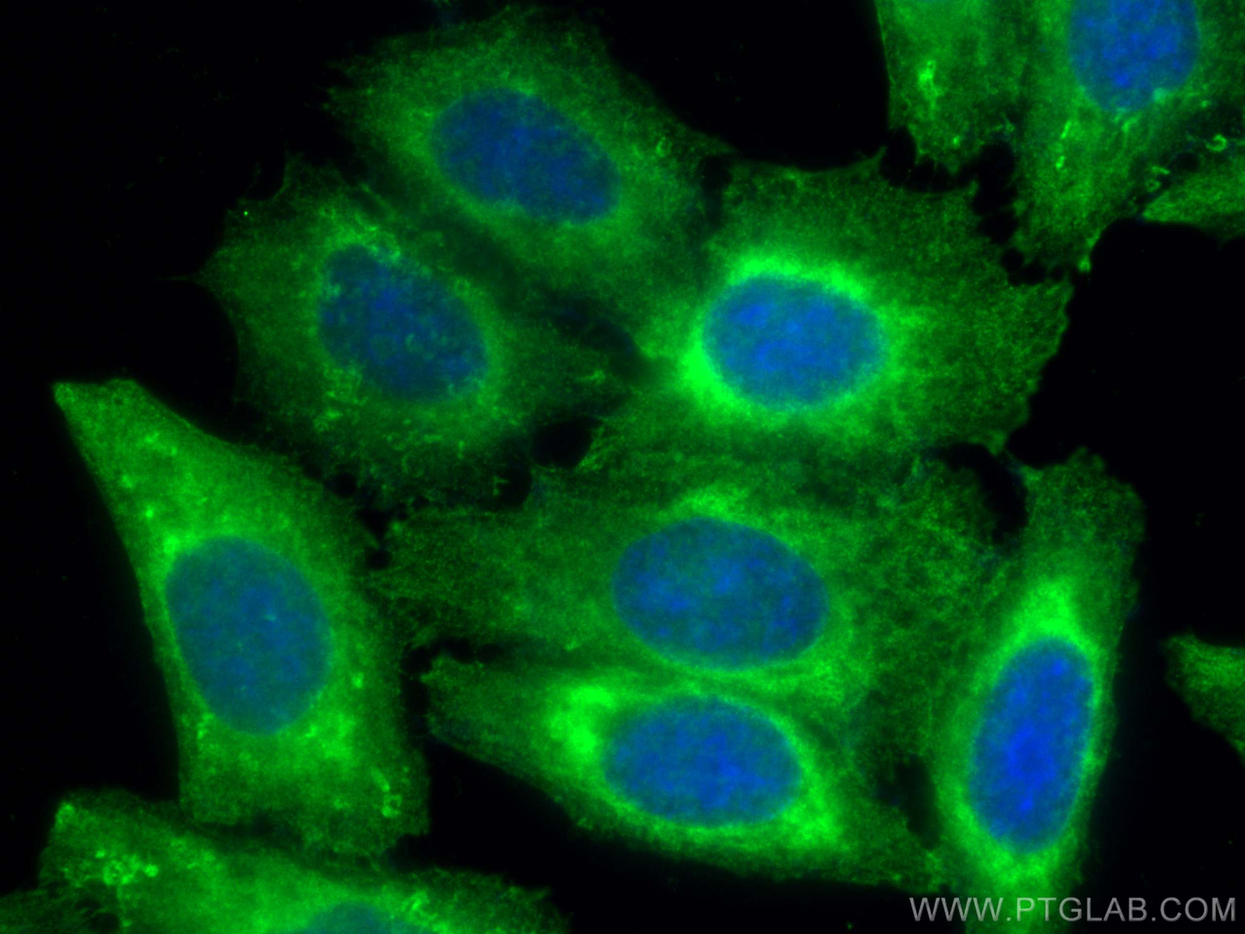 IF Staining of HepG2 using 16639-1-AP