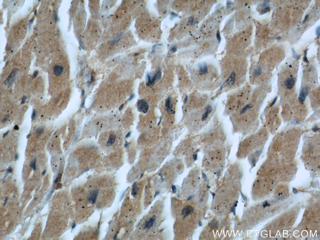 IHC staining of human heart using 66071-1-Ig (same clone as 66071-1-PBS)