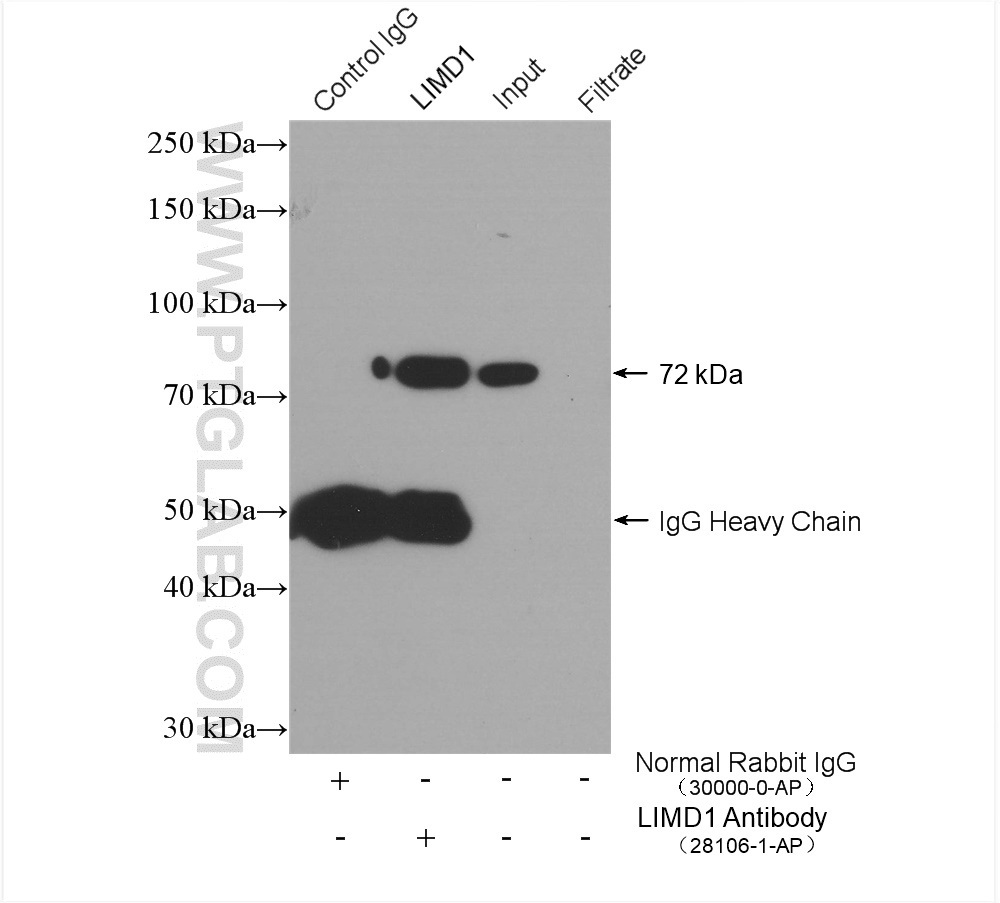 IP experiment of HeLa using 28106-1-AP