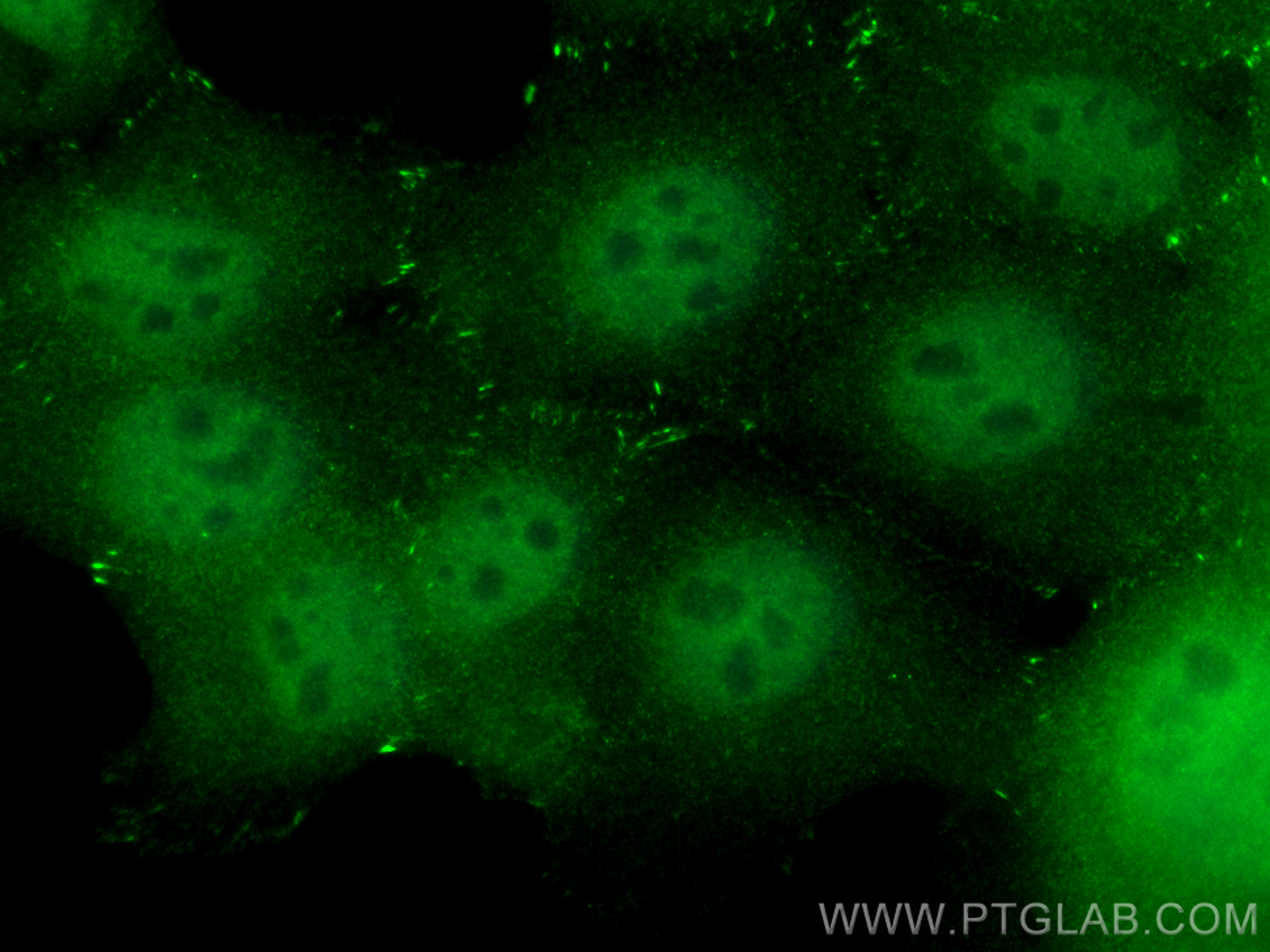 IF Staining of A431 using CL488-28106