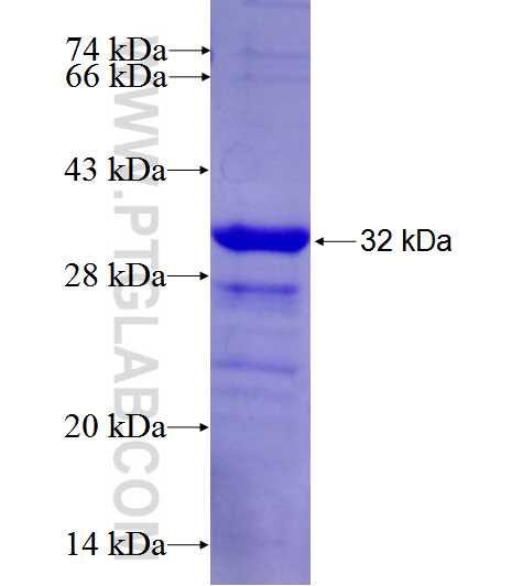 LIME1 fusion protein Ag26672 SDS-PAGE