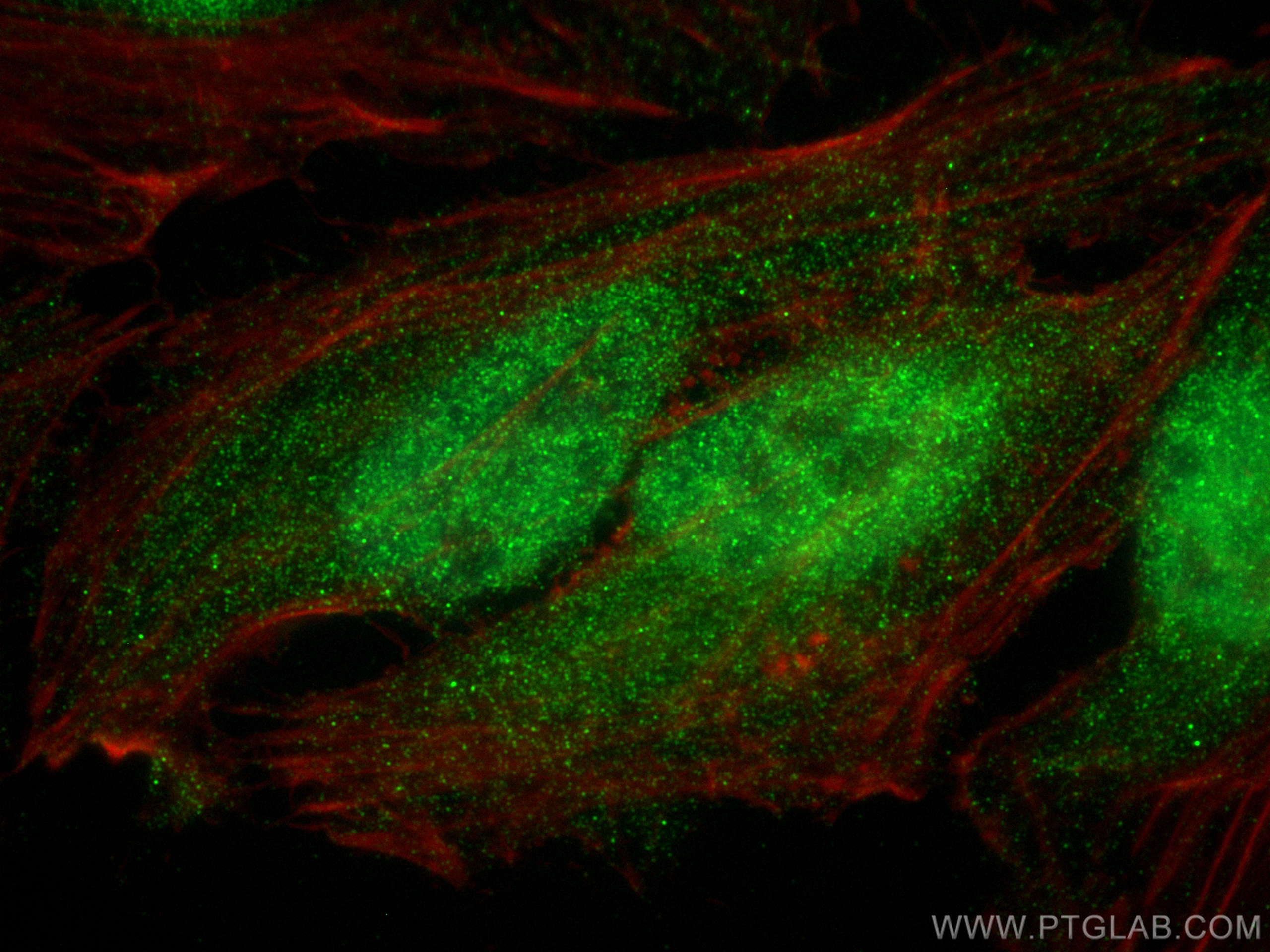 IF Staining of HeLa using 19699-1-AP