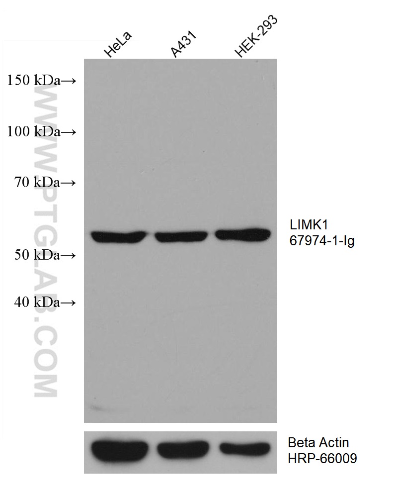 WB analysis using 67974-1-Ig