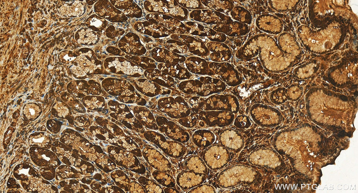 IHC staining of human stomach using 12350-1-AP