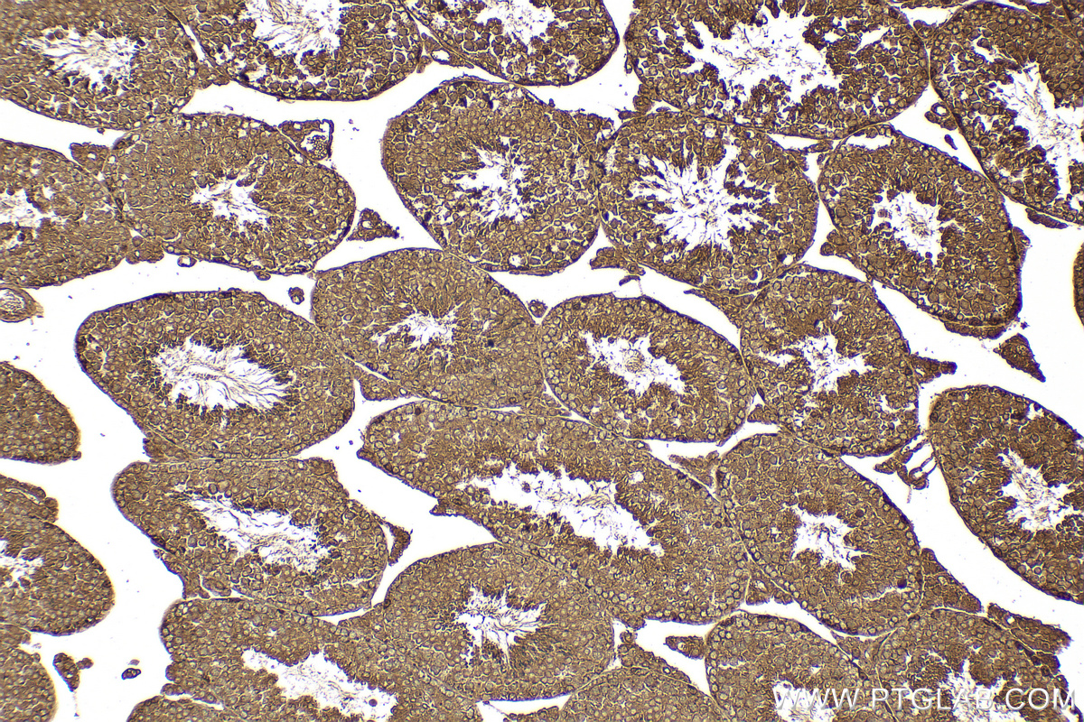 IHC staining of mouse testis using 11724-1-AP