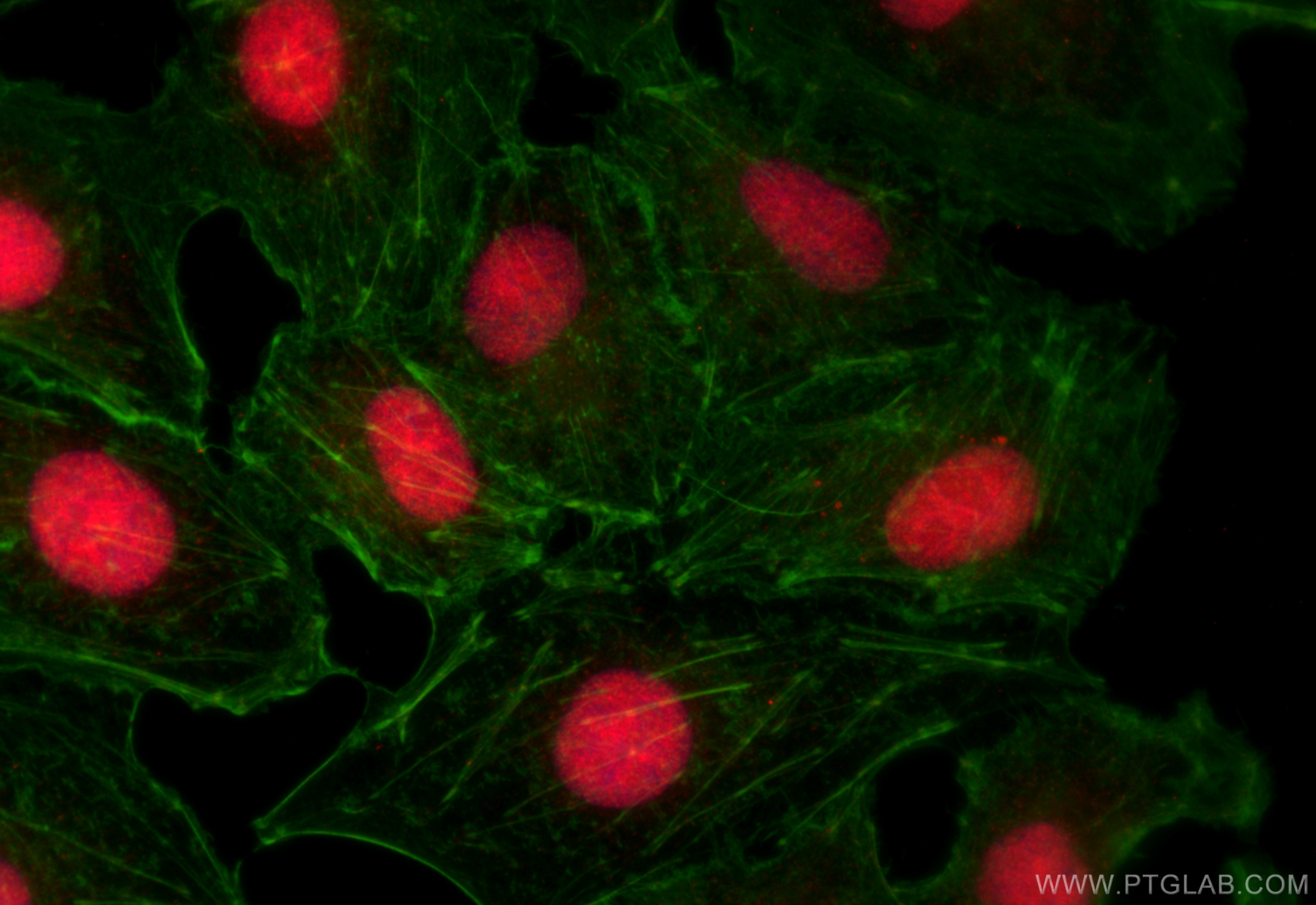 IF Staining of A549 using 26651-1-AP