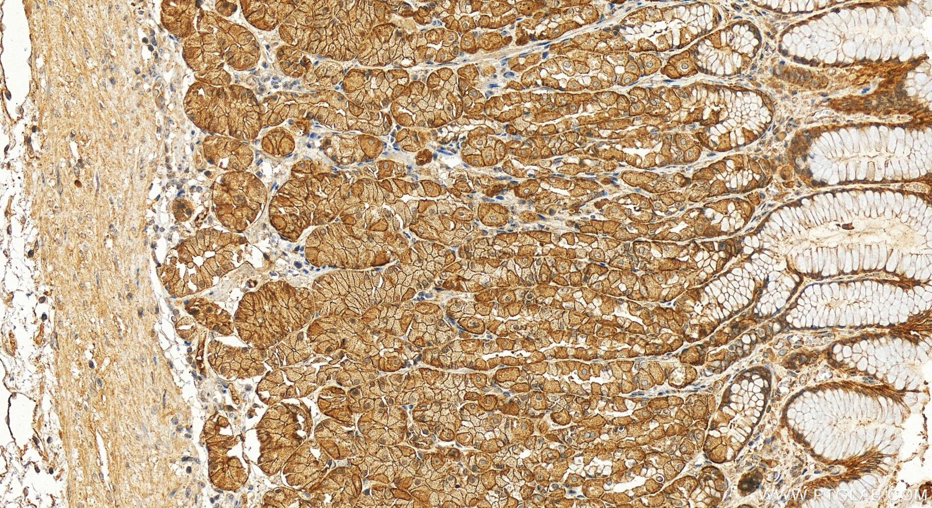 IHC staining of human stomach using 14656-1-AP